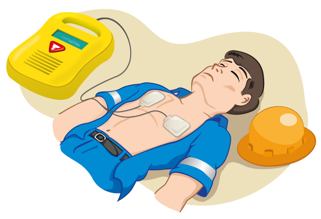 Defibrillator für Vermieter von Ferienwohnungen und Monteurzimmern Erste Hilfe Monteur Handwerker Gast